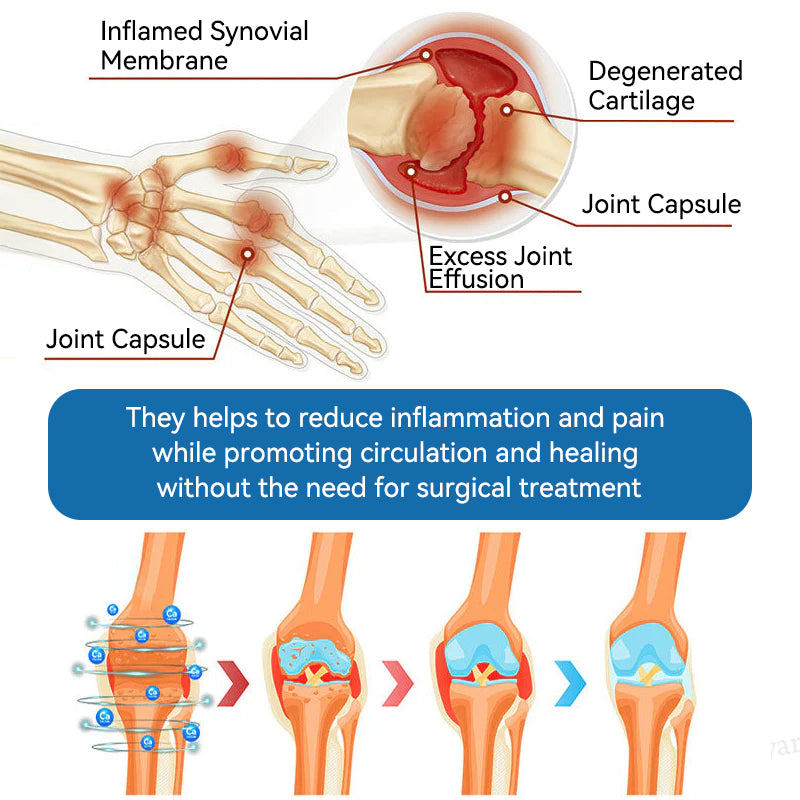 🇬🇧𝐟𝐥𝐲𝐬𝐦𝐮𝐬® 𝐁𝐏𝐂-𝟏𝟓𝟕 𝐉𝐨𝐢𝐧𝐭 𝐇𝐞𝐚𝐥𝐢𝐧𝐠 𝐂𝐫𝐞𝐚𝐦🦴Treats Arthritis, Neuropathy, Rheumatism, Sports Injuries & More🇬🇧🏆