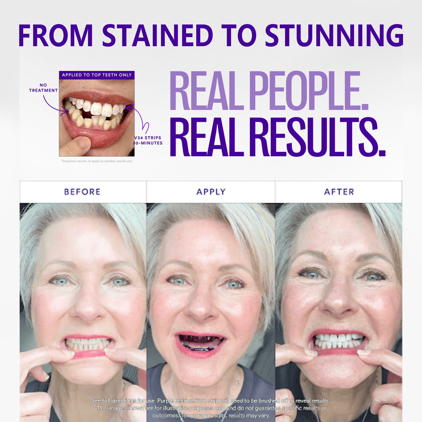 🔥V36 Whitening Strips – Professional Teeth Whitening at Home