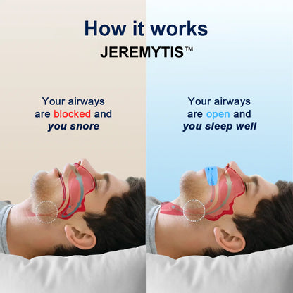 JEREMYTIS™  Professional intelligent anti-snoring device