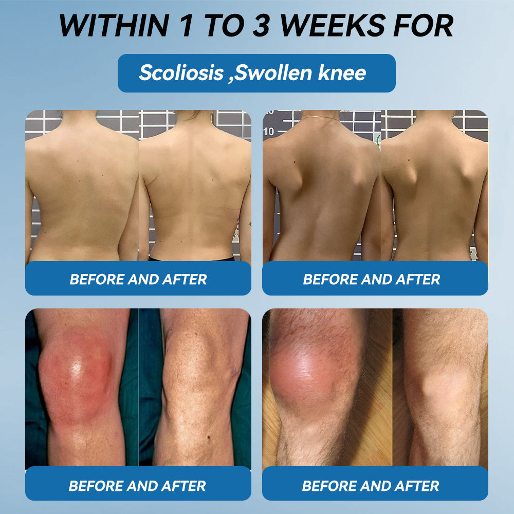 🇬🇧𝐟𝐥𝐲𝐬𝐦𝐮𝐬® 𝐁𝐏𝐂-𝟏𝟓𝟕 𝐉𝐨𝐢𝐧𝐭 𝐇𝐞𝐚𝐥𝐢𝐧𝐠 𝐂𝐫𝐞𝐚𝐦🦴Treats Arthritis, Neuropathy, Rheumatism, Sports Injuries & More🇬🇧🏆