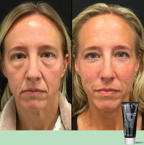 Temporary Face Tightener (🎁Buy More Save More）