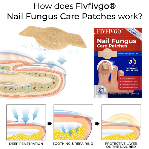 [Official Store] Nail Fungus Care Patches