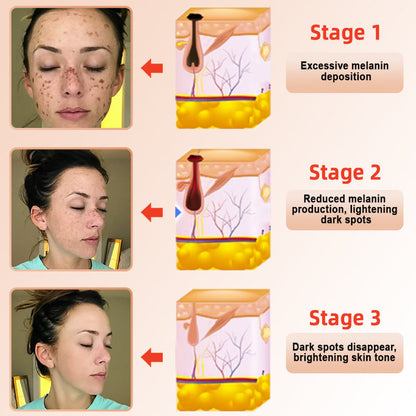 ✨[Official Store]JEREMYTIS™ Exfoliating Gel