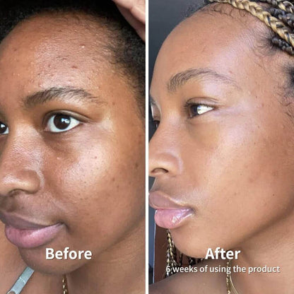 Dr. Melaxin PEEL SHOT™️