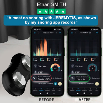 💤[Official Store] JEREMYTIS™ Professional Anti-snoring Device